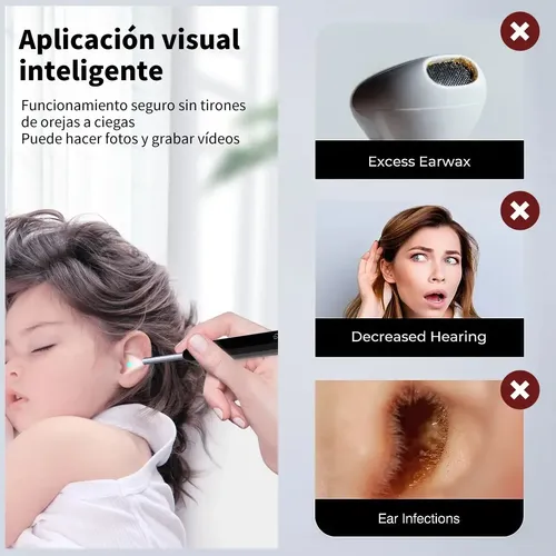 Limpia Oídos Cámara Inteligente Extractor Limpiador De Cera Endoscopio Color Negro Ne3 — foto 10