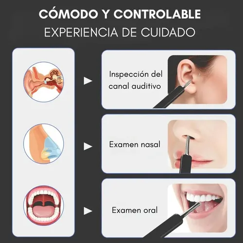 Limpia Oídos Cámara Inteligente Extractor Limpiador De Cera Endoscopio Color Negro Ne3 — foto 9